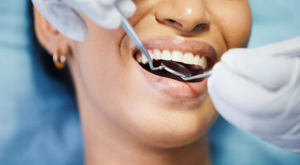 Best Emergency Dental Surgery in Kewanee, IL