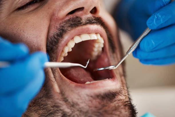 Best Walk-In Emergency Dentist in Kewanee, IL