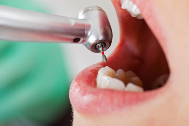Best Walk-In Emergency Dentist in Kewanee, IL